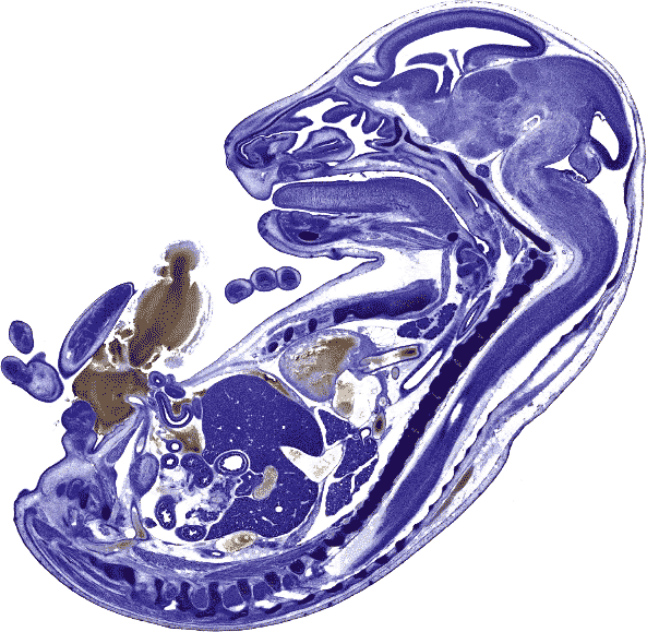 File:E17-fetus.gif