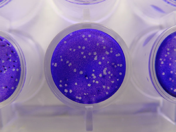 File:Plaque assay macro.jpg