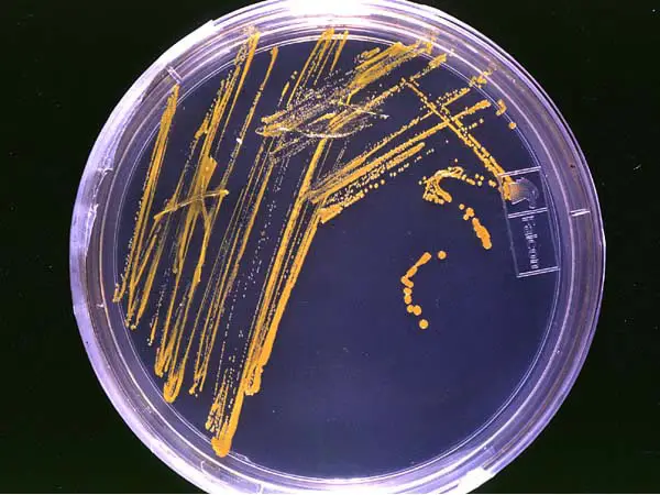 File:Agar plate with colonies.jpg