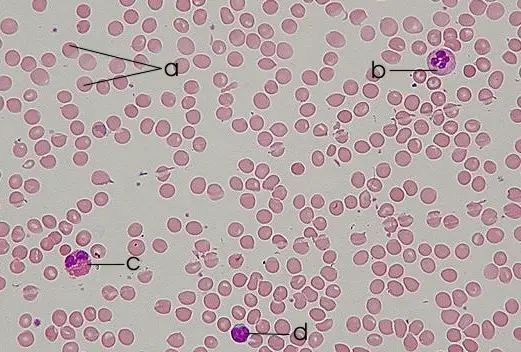 File:Blood smear.jpg
