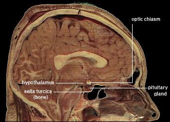 File:LocationOfHypothalamus.jpg