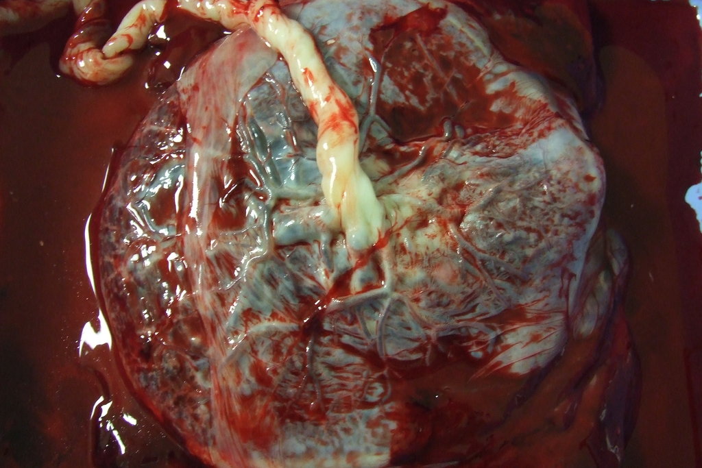 Fresh human placenta