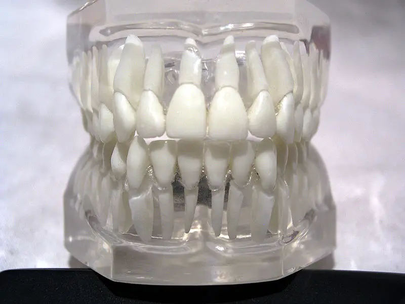 File:Teeth model front.jpg