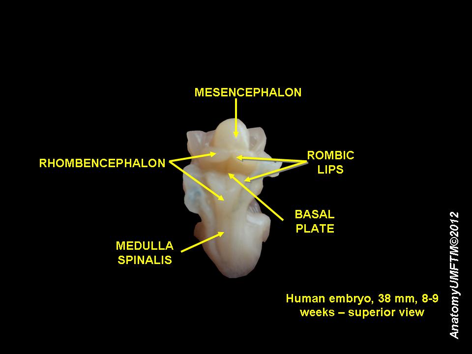 Human embryo 8 weeks 9.JPG