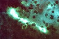 Chlamydophila psittaci FA stain.jpg