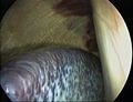 Thumbnail for version as of 22:09, 10 May 2007