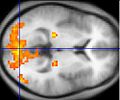 Thumbnail for version as of 02:43, 20 February 2007