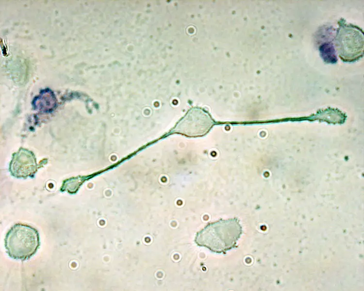 File:Macrophage.jpg