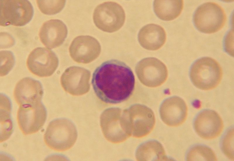 File:Lymphocyte2.jpg
