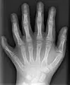 Thumbnail for version as of 22:35, 23 May 2006