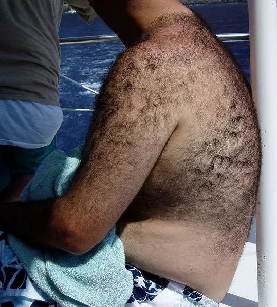 File:Backhair.jpg