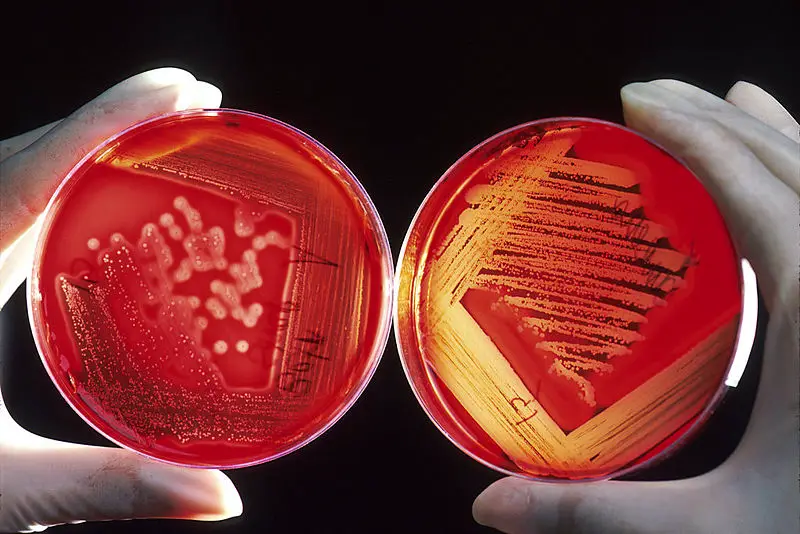 File:Agarplate redbloodcells.jpg