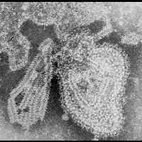 TEM micrograph of the mumps virus.
