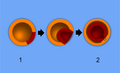 Thumbnail for version as of 01:55, 14 September 2008