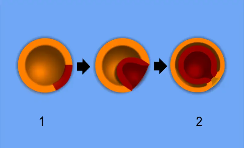 File:Gastrulation.png