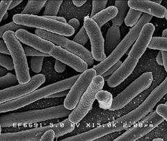 These Escherichia coli cells provide an example of a microorganism