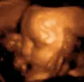 Thumbnail for version as of 15:59, 14 July 2006