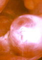 Thumbnail for version as of 19:35, 13 May 2006
