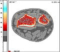 Thumbnail for version as of 00:01, 10 November 2008