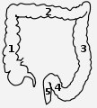Thumbnail for version as of 22:43, 16 July 2008