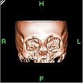 Thumbnail for version as of 02:26, 7 December 2007
