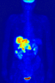 Thumbnail for version as of 14:19, 7 November 2007