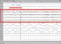 Thumbnail for version as of 16:55, 15 October 2007