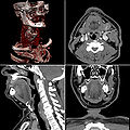 Thumbnail for version as of 02:26, 7 December 2007