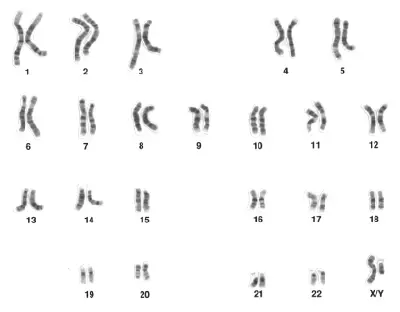 Chromosome - New World Encyclopedia