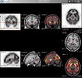 Thumbnail for version as of 23:42, 9 October 2008