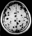Thumbnail for version as of 19:34, 15 February 2009