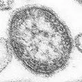 Thumbnail for version as of 10:19, 4 August 2006