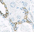 Thumbnail for version as of 02:35, 24 May 2008