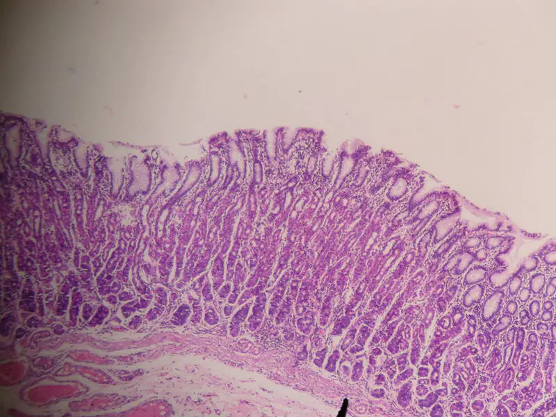 File:Stomach.JPG
