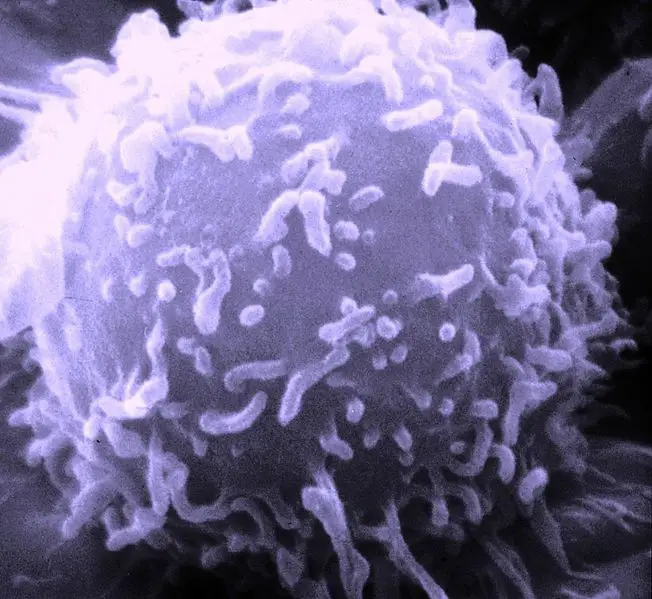 File:SEM Lymphocyte.jpg