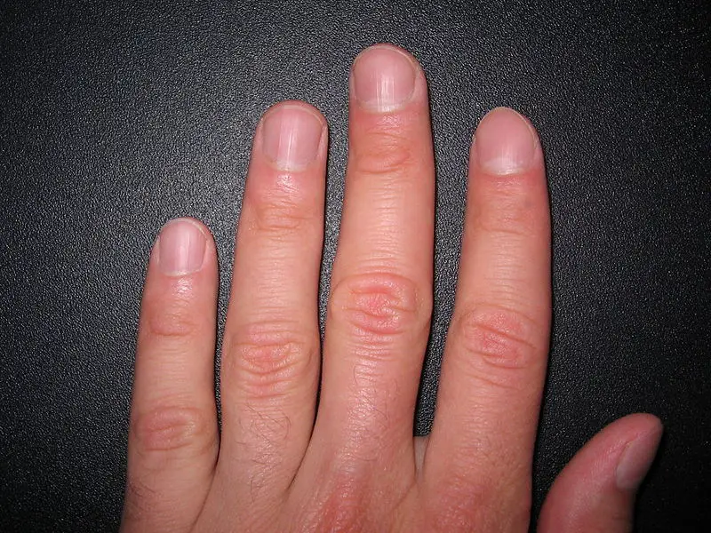 File:Fingernails1.JPG