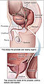 Thumbnail for version as of 15:57, 28 June 2006