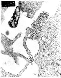 A TEM micrograph showing dengue virus