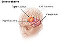 Thumbnail for version as of 19:40, 19 May 2007