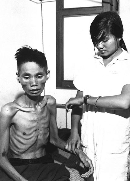 File:Starved Vietnamese man, 1966.JPEG