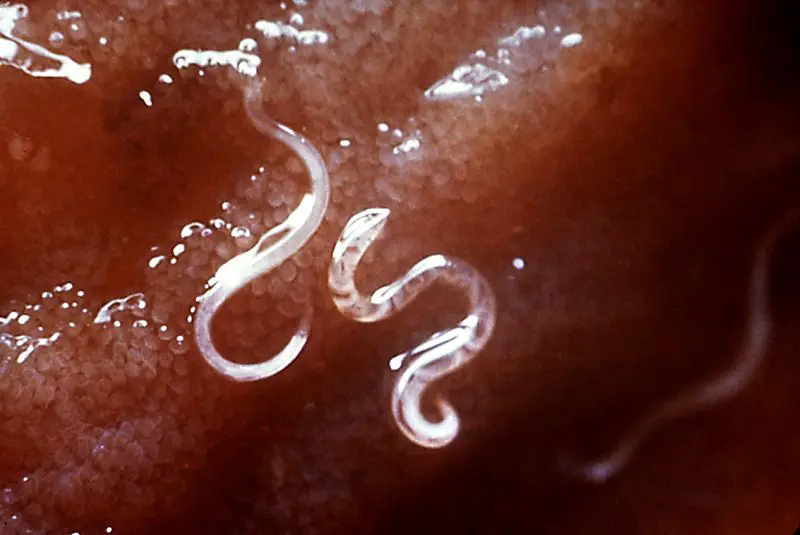 File:Hookworms.JPG