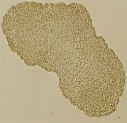 Light microscope image of Trichoplax (specimen around 0.5 millimeters across)