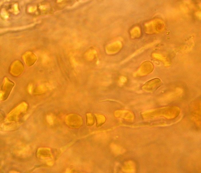 File:Hyella caespitosa hypae.jpg