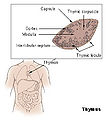 Thumbnail for version as of 02:11, 9 May 2007