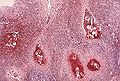 Thumbnail for version as of 22:01, 8 December 2007