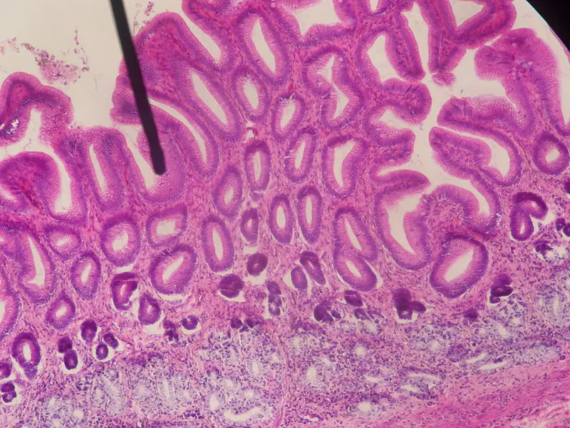 File:Pyloric stomach LPO.JPG