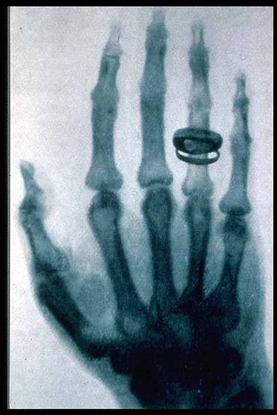 File:Roentgen-x-ray-von-kollikers-hand.jpg