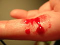 Thumbnail for version as of 17:07, 31 August 2008