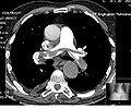 Thumbnail for version as of 00:02, 10 November 2008