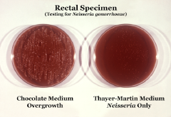 Neisseria gonorrhoeae cultured on two different media types.